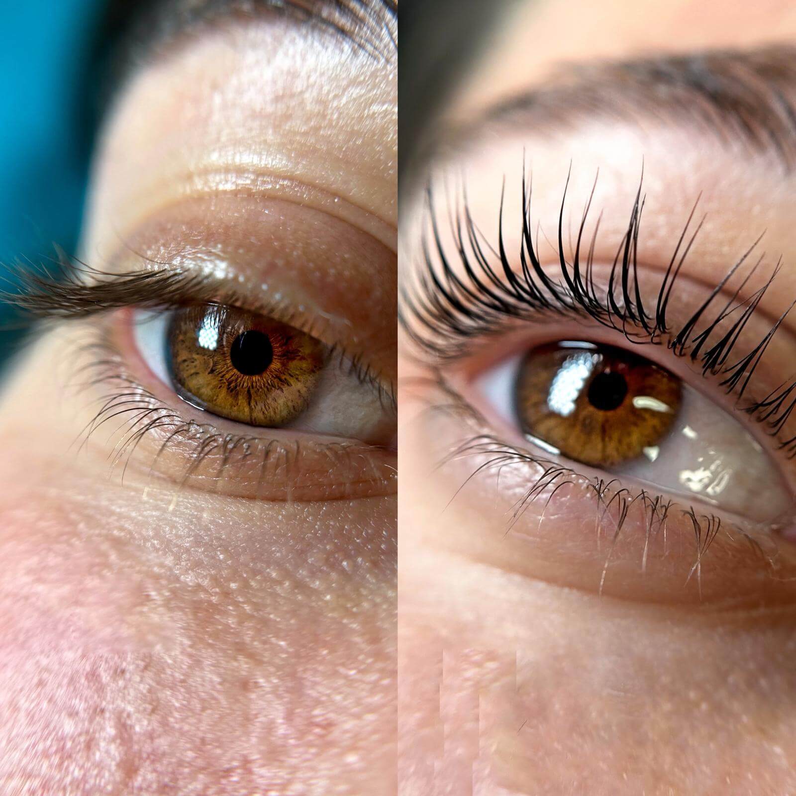 ליטל אסתטיקה 