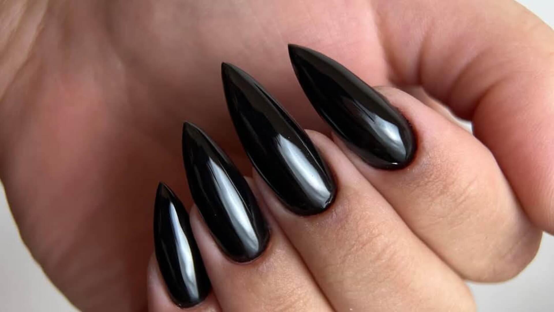 אורטל אוחנה 